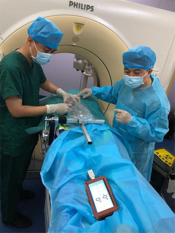 經(jīng)典病例之穿刺模板引導(dǎo)肺小結(jié)節(jié)同針道活檢消融2 經(jīng)典病例之穿刺模板引導(dǎo)肺小結(jié)節(jié)同針道活檢消融2