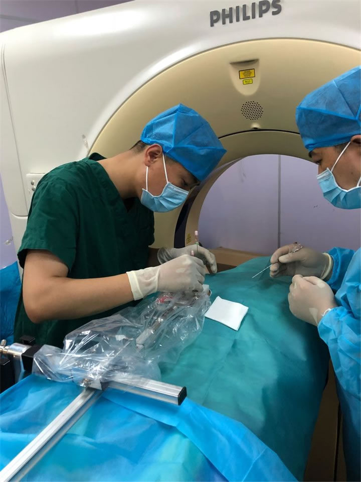 經(jīng)典病例之穿刺模板引導(dǎo)肺小結(jié)節(jié)同針道活檢消融6