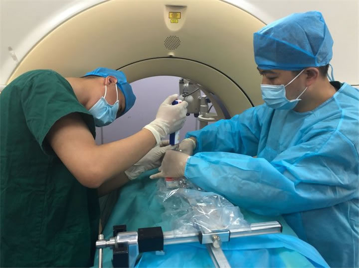 經(jīng)典病例之穿刺模板引導(dǎo)肺小結(jié)節(jié)同針道活檢消融9