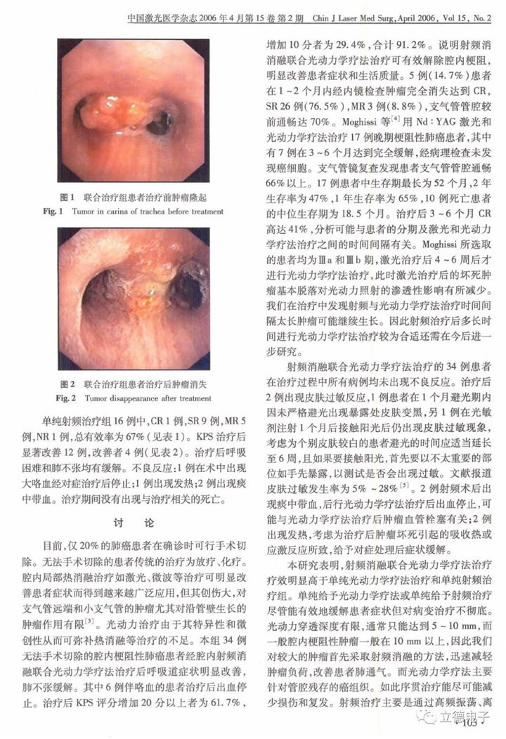 內(nèi)鏡下射頻消融聯(lián)合光動(dòng)力療法治療無(wú)法手術(shù)切除的梗阻性肺癌3