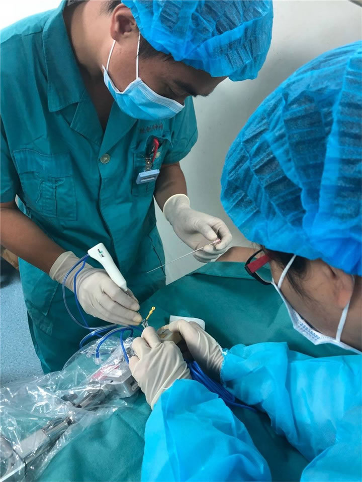 唐山市人民醫(yī)院陳寶明教授團(tuán)隊采用共面模板穿刺技術(shù)行肺小結(jié)節(jié)射頻消融一例分享7